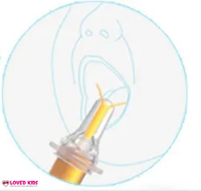 Kids Medicine Feeder/Dispenser - Image 4